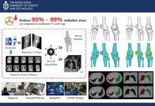 Scientists in Hong Kong unveil new AI technology for safer and faster 3D medical imaging.