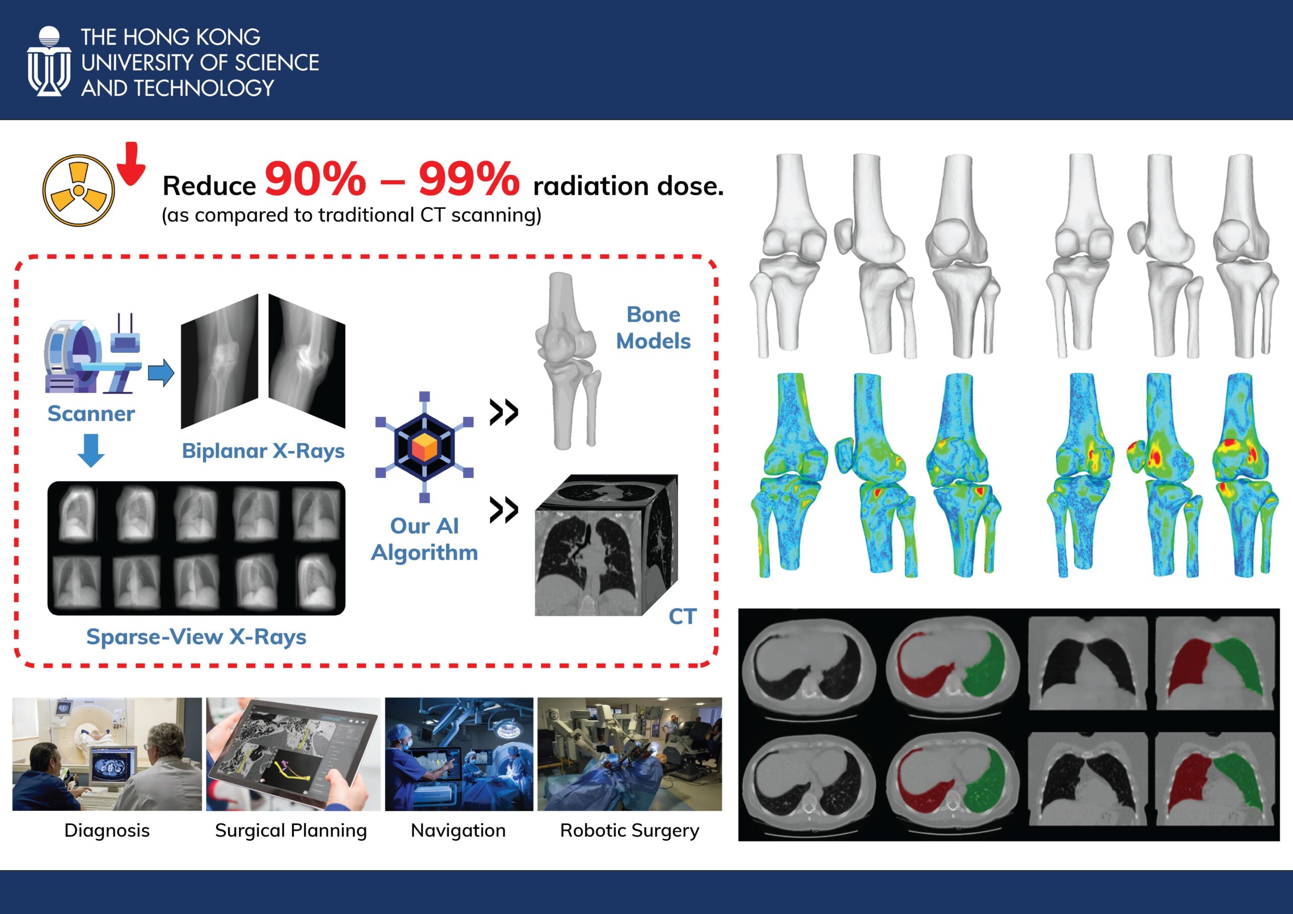 Scientists in Hong Kong unveil new AI technology for safer and faster 3D medical imaging.