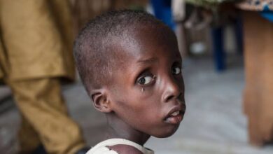 Nigeria Now Ranks 2nd Worst in Global Malnutrition - Presidency Raises Alarm